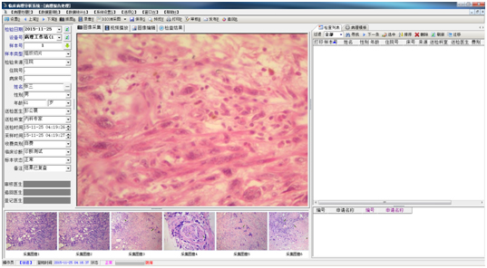 病理图文系统